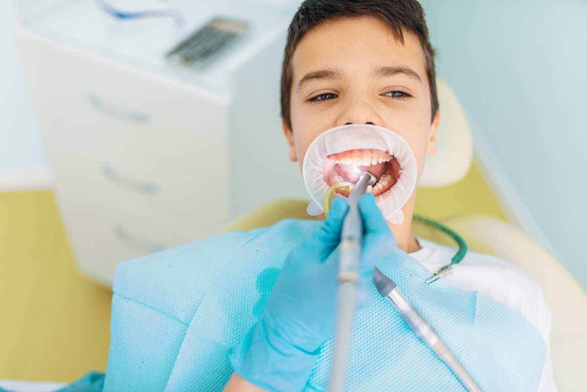 Curiamo i denti cariati o danneggiati